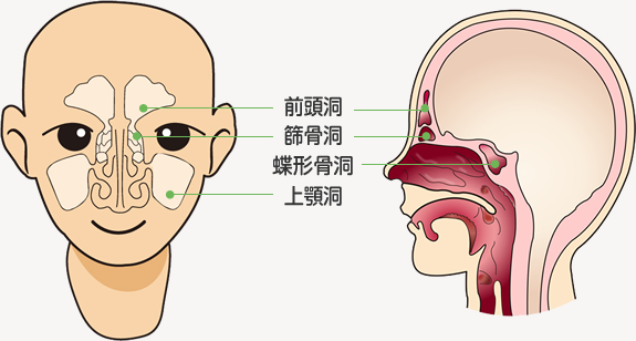 治し 炎 方 鼻腔 自宅 副